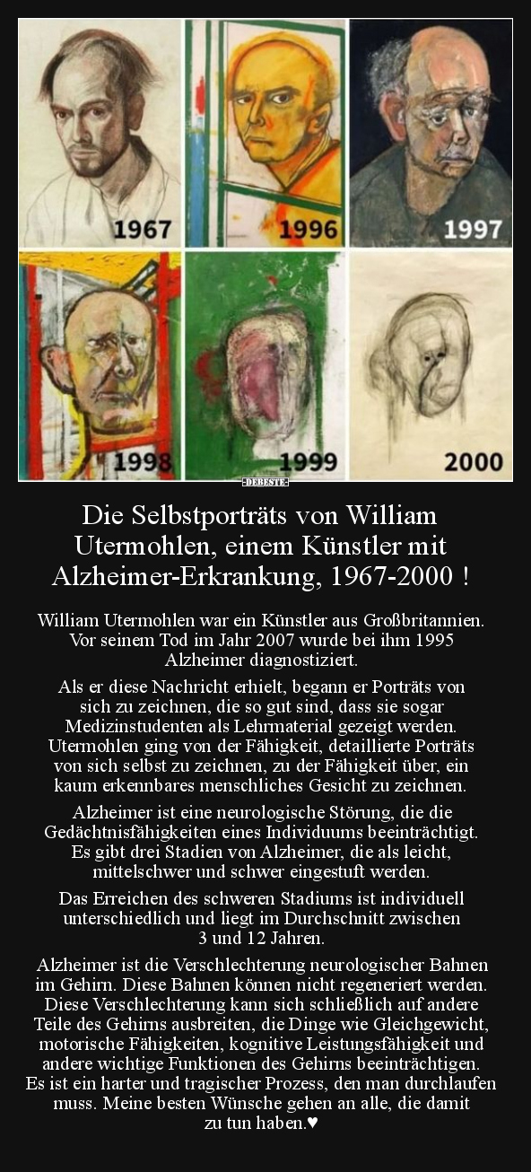 Die Selbstporträts von William Utermohlen, einem Künstler.. - Lustige Bilder | DEBESTE.de
