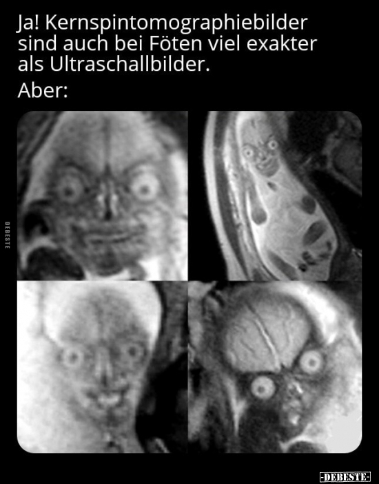 Ja! Kernspintomographiebilder sind auch bei Föten viel.. - Lustige Bilder | DEBESTE.de