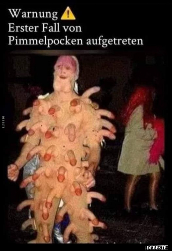 Warnung! Erster Fall von Pimm*elpocken aufgetreten.. - Lustige Bilder | DEBESTE.de