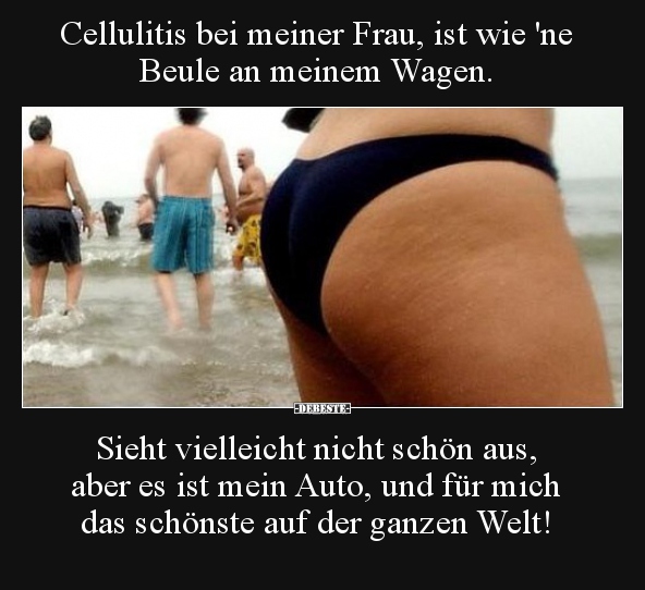 Cellulitis bei meiner Frau, ist wie 'ne Beule an meinem Wagen. - Lustige Bilder | DEBESTE.de
