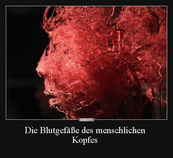 Die Blutgefäße des menschlichen Kopfes.. - Lustige Bilder | DEBESTE.de