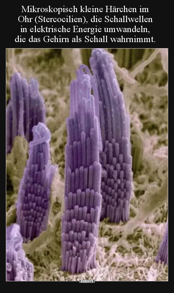Mikroskopisch kleine Härchen im Ohr (Stercocilien), die.. - Lustige Bilder | DEBESTE.de