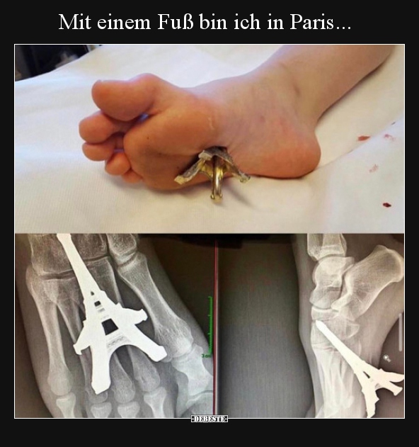 Mit einem Fuß bin ich in Paris...