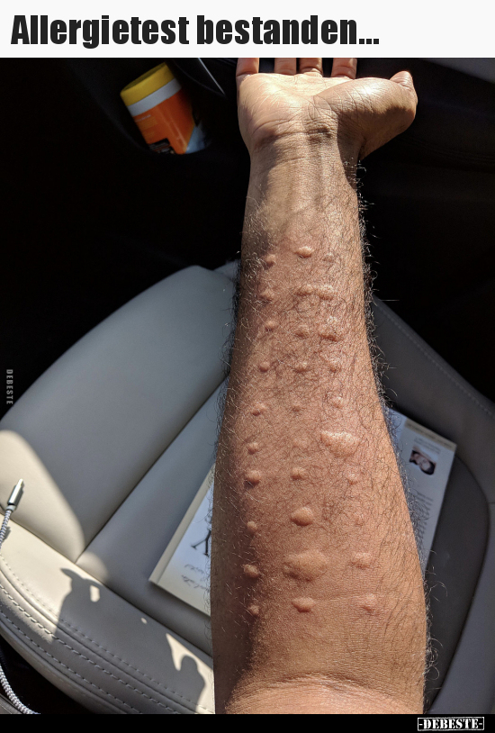 Allergietest bestanden...