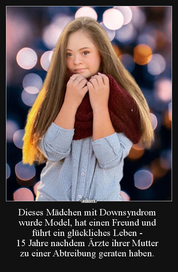 Dieses Mädchen mit Downsyndrom wurde Model, hat einen.. - Lustige Bilder | DEBESTE.de