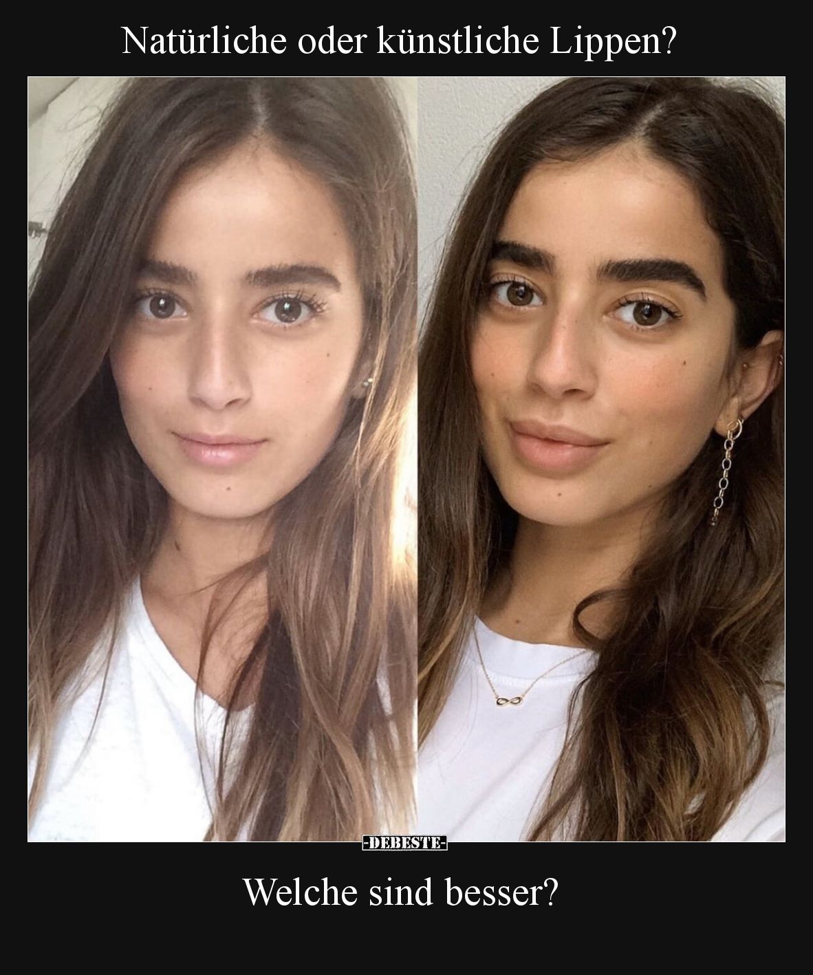 Natürliche oder künstliche Lippen? Welche sind besser?