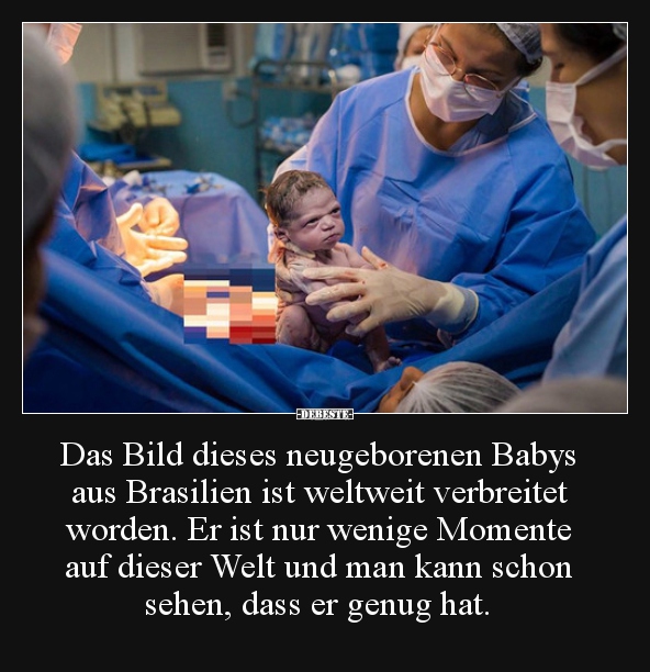 Das Bild dieses neugeborenen Babys aus Brasilien ist.. - Lustige Bilder | DEBESTE.de