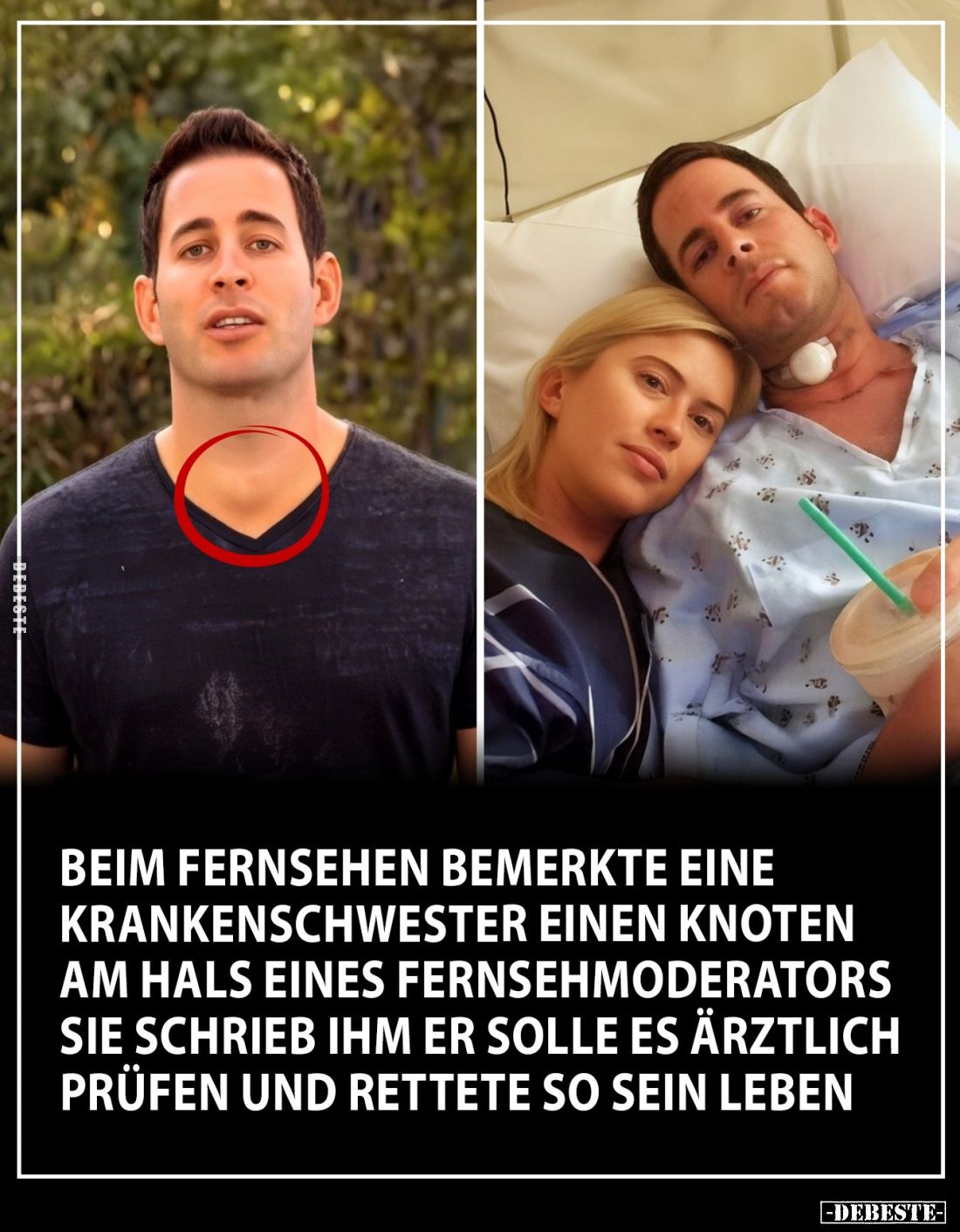 Beim fernsehen bemerkte eine Krankenschwester einen Knoten am Hals eines Fernsehmoderators. Sie schrieb ihm er solle es ärztl...