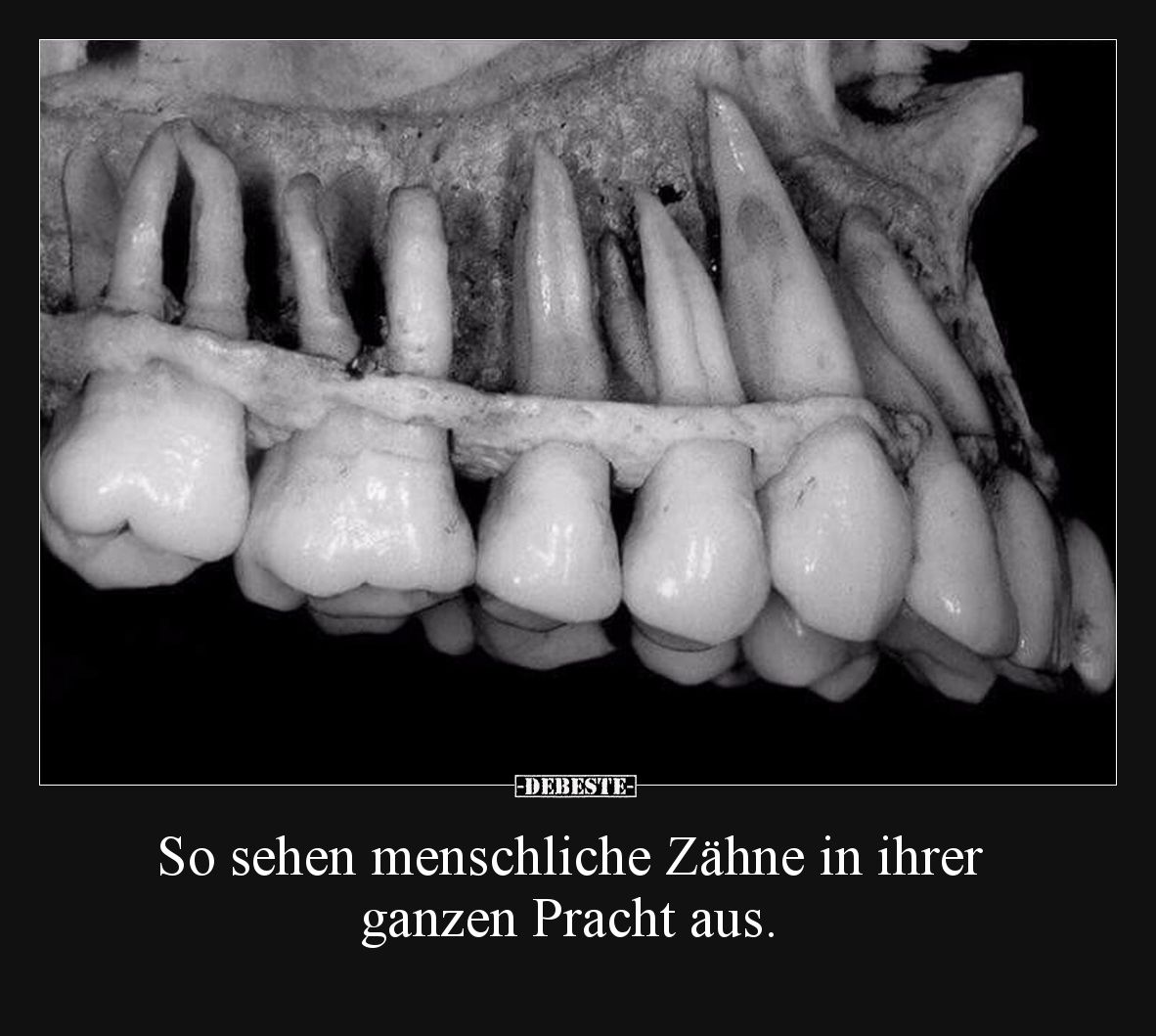 So sehen menschliche Zähne in ihrer ganzen Pracht aus.