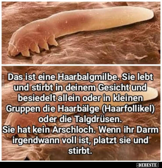 Das ist eine Haarbalgmilbe. Sie lebt und stirbt in deinem..