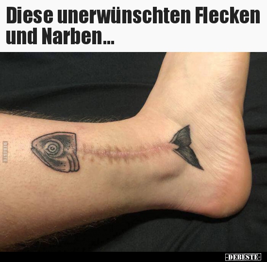 Diese unerwünschten Flecken und Narben... - Lustige Bilder | DEBESTE.de