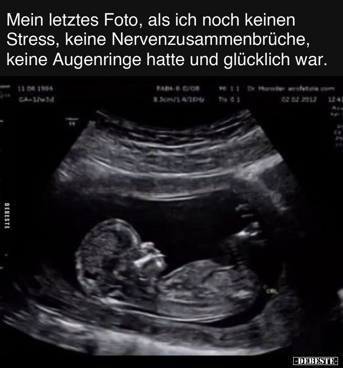 Mein letztes Foto, als ich noch keinen Stress, keine Nervenzusammenbrüche, keine Augenringe hatte und glücklich war.