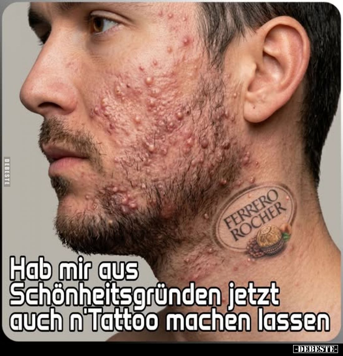 Hab mir aus Schönheitsgründen jetzt auch n'Tattoo machen lassen