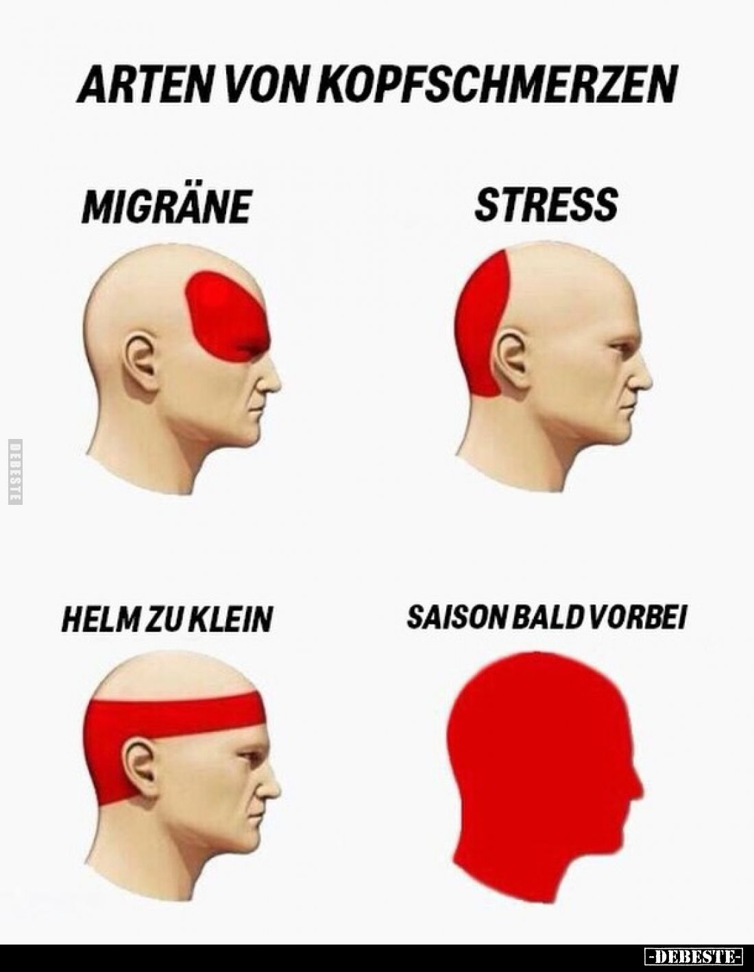 Arten von Kopfschmerzen
-
Migräne
-
Stress
-
Helm zu klein
-
Saison bald vorbei