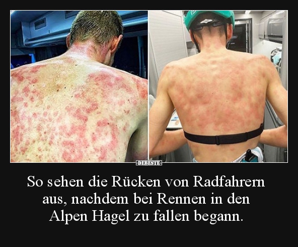 So sehen die Rücken von Radfahrern aus, nachdem bei Rennen.. - Lustige Bilder | DEBESTE.de