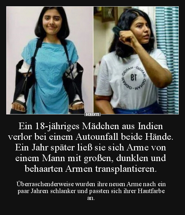 Ein 18-jähriges Mädchen aus Indien verlor bei einem.. - Lustige Bilder | DEBESTE.de