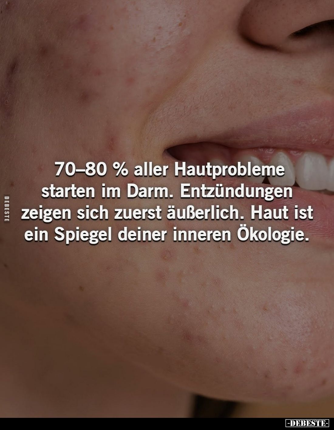 70-80% aller Hautprobleme starten im Darm. Entzündungen zeigen sich zuerst äußerlich. Haut ist ein Spiegel deiner inneren Öko...