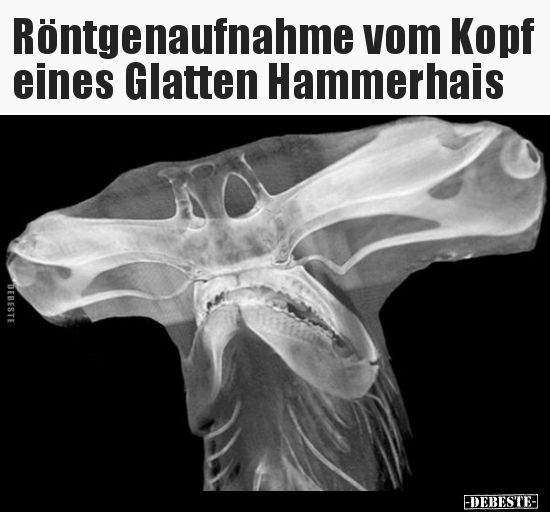 Röntgenaufnahme vom Kopf eines Glatten Hammerhais.. - Lustige Bilder | DEBESTE.de