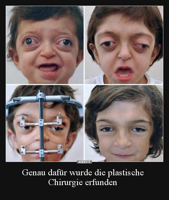 Genau dafür wurde die plastische Chirurgie erfunden.. - Lustige Bilder | DEBESTE.de