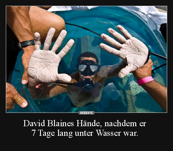 David Blaines Hände, nachdem er 7 Tage.. - Lustige Bilder | DEBESTE.de
