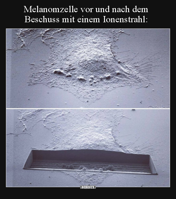 Melanomzelle vor und nach dem Beschuss mit einem.. - Lustige Bilder | DEBESTE.de