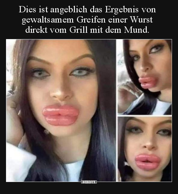 Dies ist angeblich das Ergebnis von gewaltsamem Greifen..