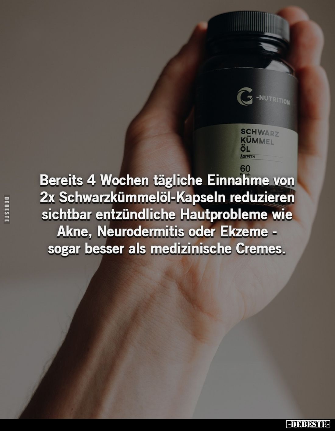 Bereits 4 Wochen tägliche Einnahme von 2x Schwarzkümmelöl-Kapseln reduzieren sichtbar entzündliche Hautprobleme wie Akne, Neu...