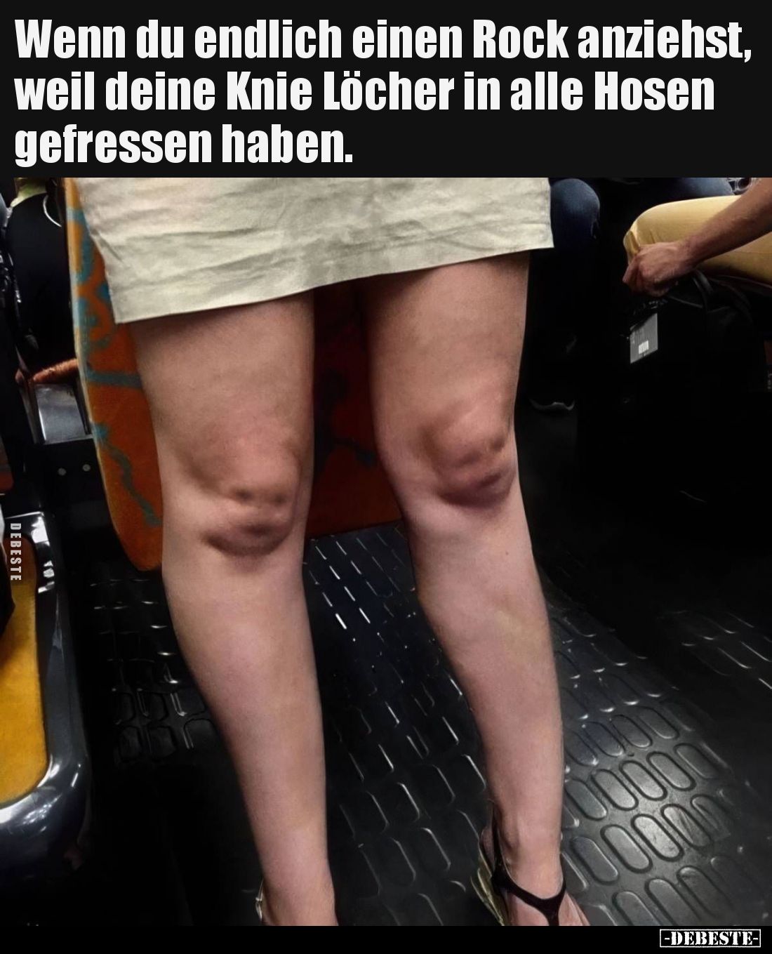 Wenn du endlich einen Rock anziehst, weil deine Knie Löcher in alle Hosen gefressen haben.