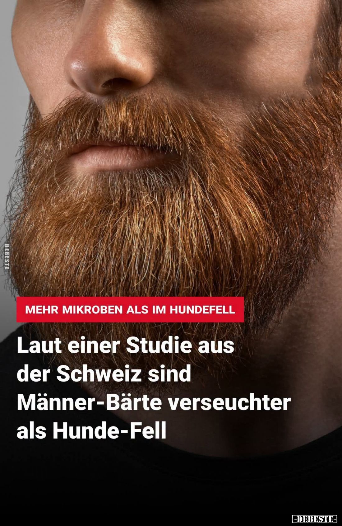 Mehr Mikroben als im Hundefell. - Laut einer Studie aus der Schweiz sind Männer-Bärte verseuchter als Hunde-Fell.