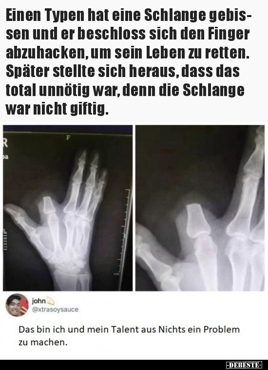 Einen Typen hat eine Schlange gebissen und er beschloss.. - Lustige Bilder | DEBESTE.de