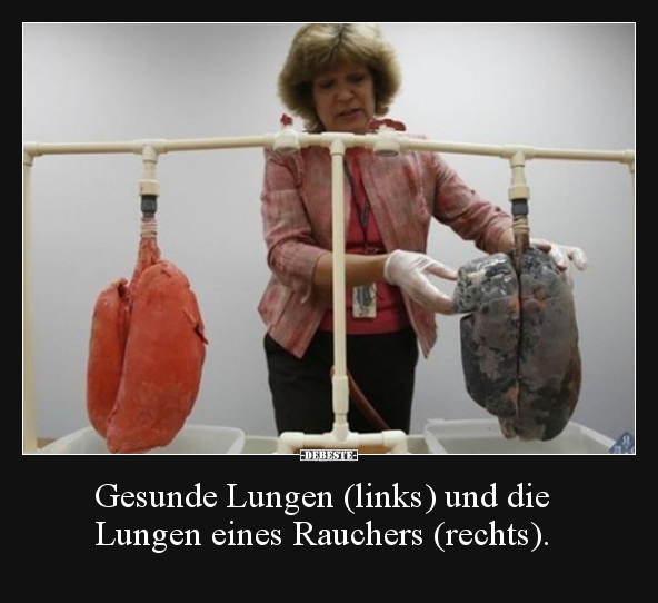 Gesunde Lungen (links) und die Lungen eines Rauchers..