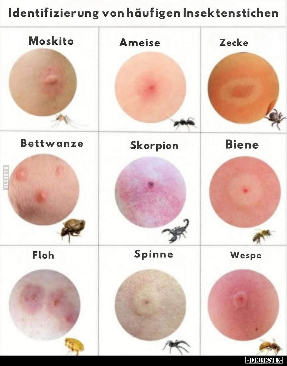 Identifizierung von häufigen Insektenstichen:
Moskito,
Ameise,
Zecke,
Bettwanze,
Skorpion,
Biene,
Floh,
Spinne,
Wesp...