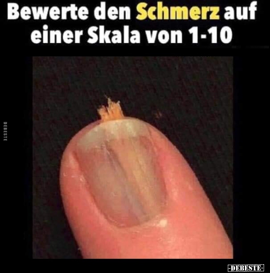 Bewerte den Schmerz auf einer Skala von 1-10..
