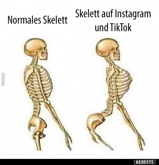 Normales Skelett - Skelett auf Instagram.. - Lustige Bilder | DEBESTE.de