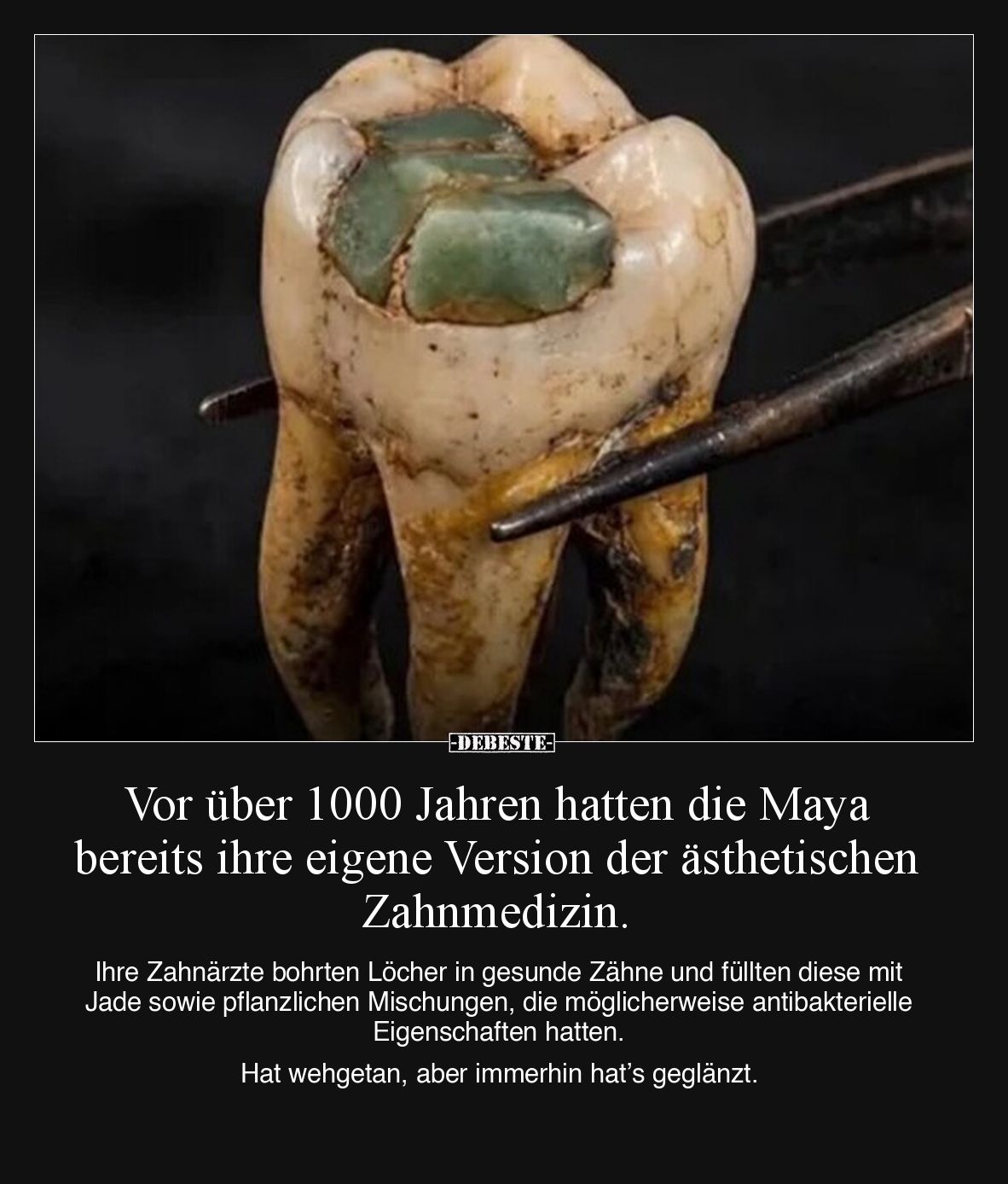 Vor über 1000 Jahren hatten die Maya bereits ihre eigene Version der ästhetischen Zahnmedizin.

Ihre Zahnärzte bohrten Löch...