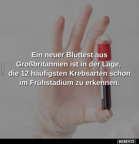 Ein neuer Bluttest aus Großbritannien ist in der Lage.. - Lustige Bilder | DEBESTE.de