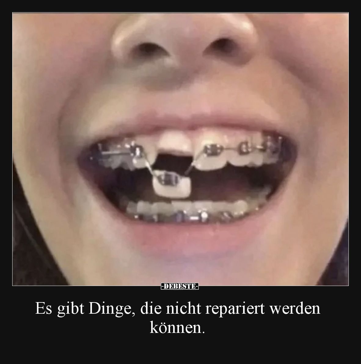 Es gibt Dinge, die nicht repariert werden können.