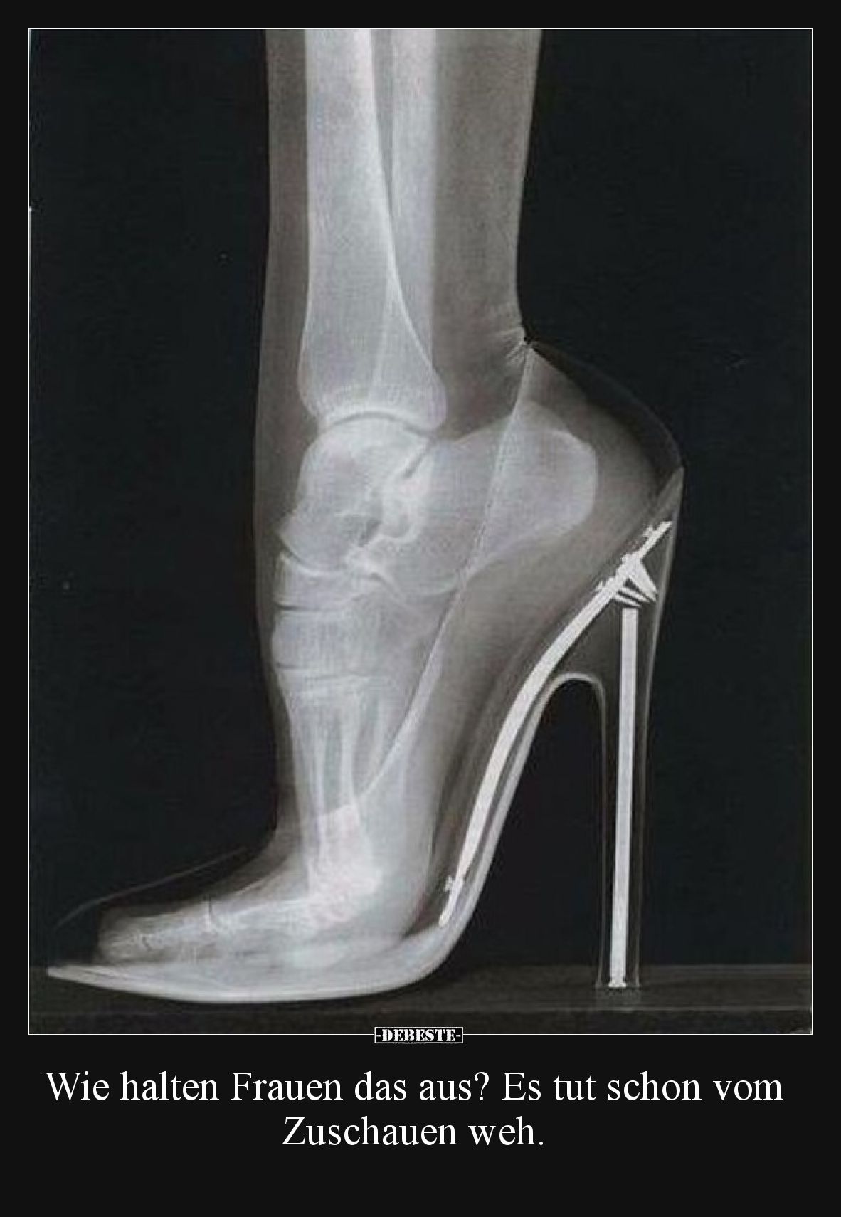 Wie halten Frauen das aus? Es tut schon vom Zuschauen weh.