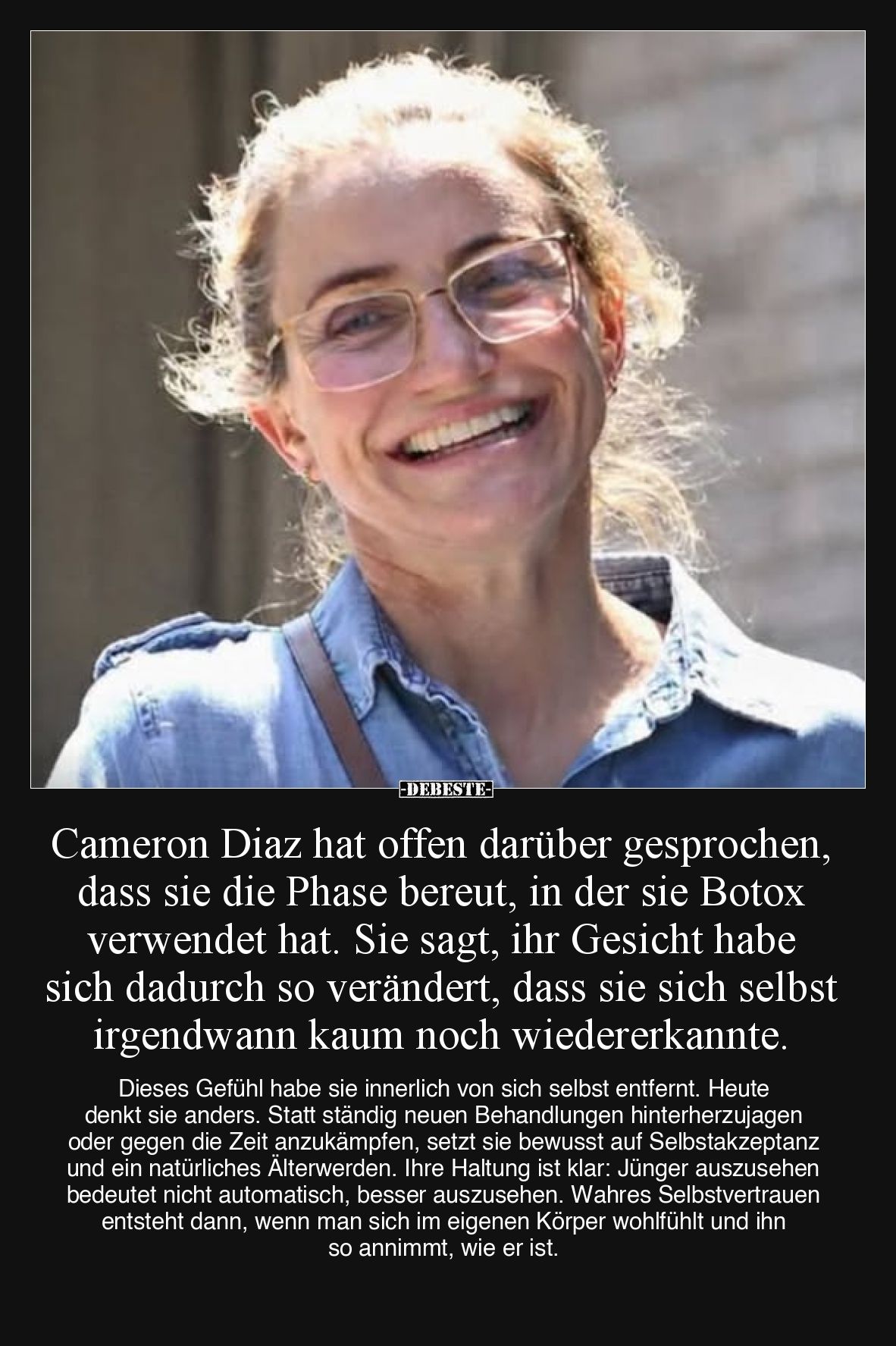Cameron Diaz hat offen darüber gesprochen, dass sie die Phase bereut, in der sie Botox verwendet hat. Sie sagt, ihr Gesicht h...
