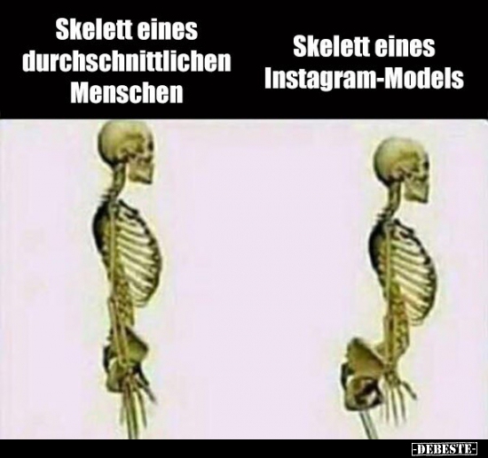 Skelett eines Instagram-Models.. - Lustige Bilder | DEBESTE.de