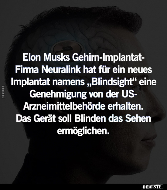 Elon Musks Gehirn-Implantat- Firma Neuralink.. - Lustige Bilder | DEBESTE.de