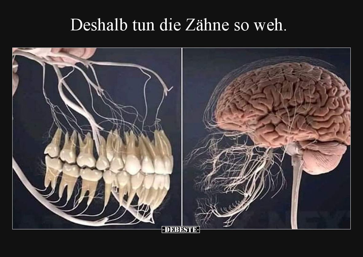 Deshalb tun die Zähne so weh.