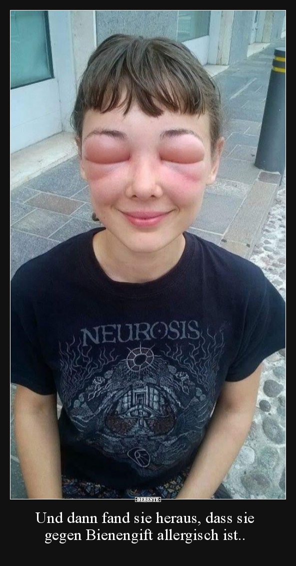 Und dann fand sie heraus, dass sie gegen Bienengift..