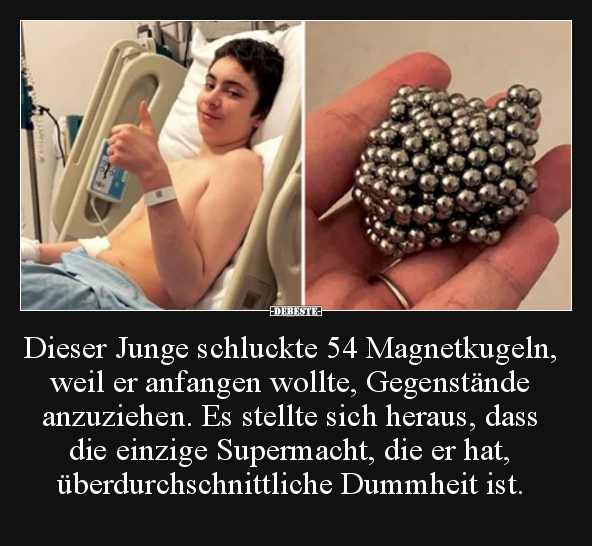 Dieser Junge schluckte 54 Magnetkugeln, weil er anfangen.. - Lustige Bilder | DEBESTE.de