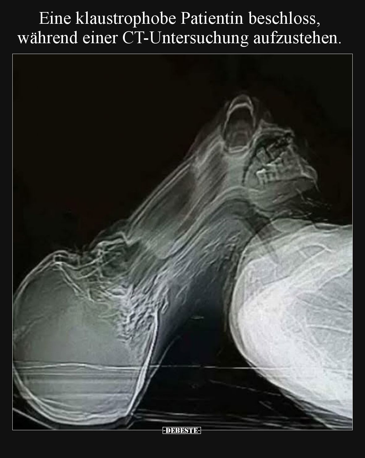 Eine klaustrophobe Patientin beschloss, während einer CT-Untersuchung aufzustehen