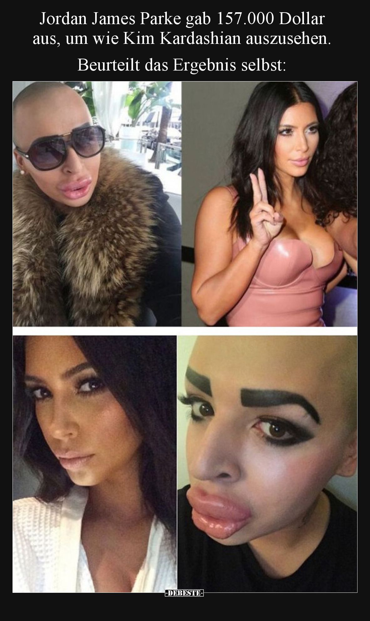Jordan James Parke gab 157.000 Dollar aus, um wie Kim Kardashian auszusehen. Beurteilt das Ergebnis selbst: