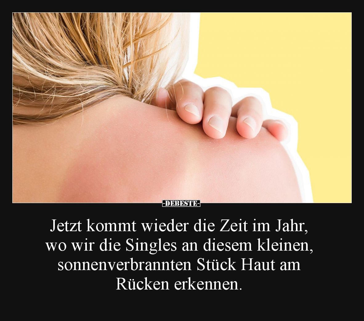 Jetzt kommt wieder die Zeit im Jahr, wo wir die Singles an diesem kleinen, sonnenverbrannten Stück Haut am Rücken erkennen.
