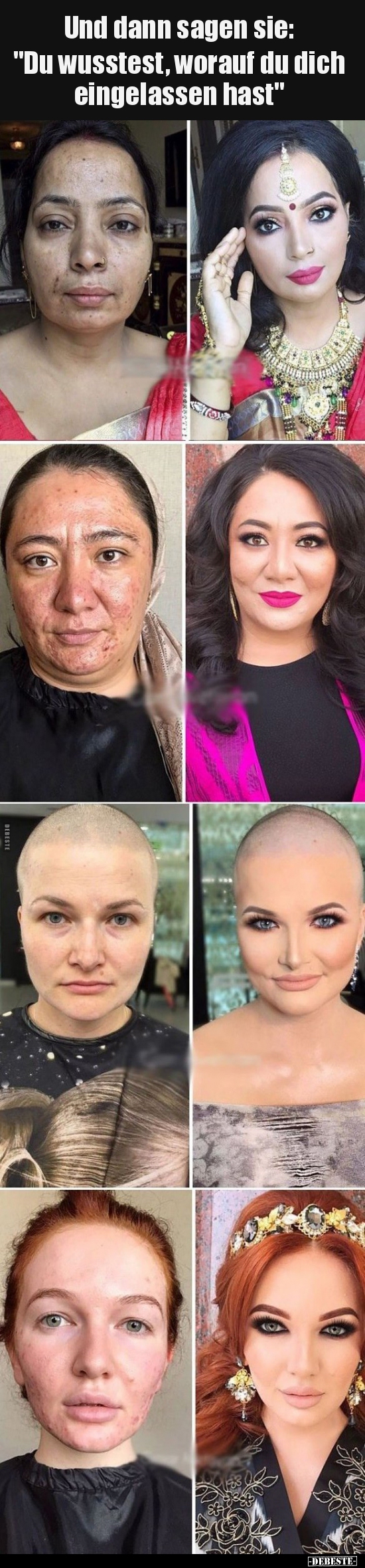 Und dann sagen sie: "Du wusstest, worauf du.."