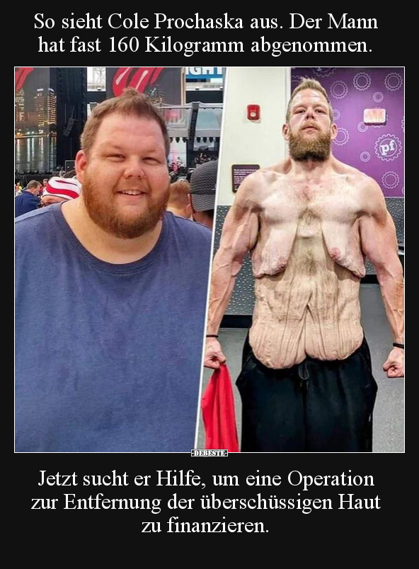 So sieht Cole Prochaska aus. Der Mann hat fast 160 Kilogramm abgenommen ...