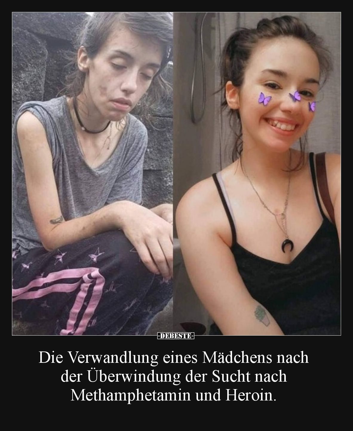 Die Verwandlung eines Mädchens nach der Überwindung der Sucht nach Methamphetamin und Heroin.